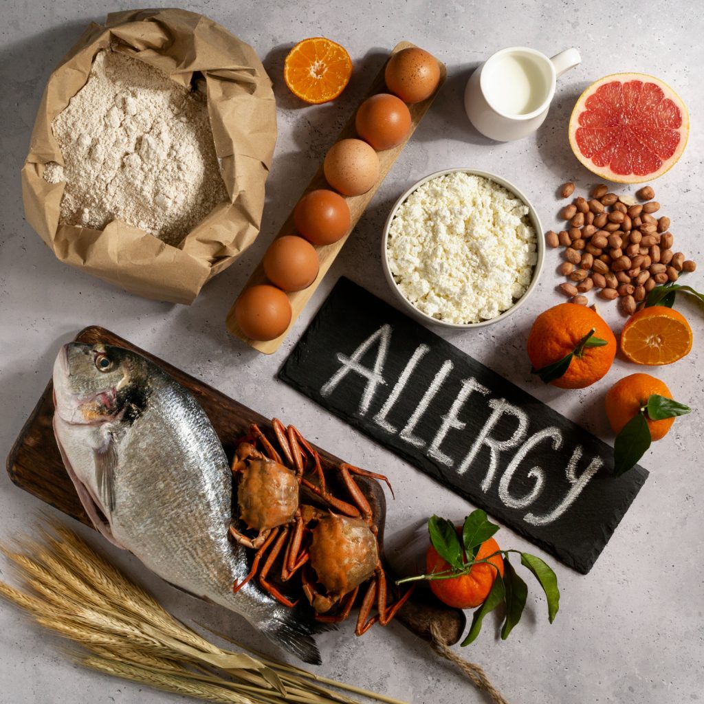 TYPES OF FOOD ALLERGIES YOU NEED TO KNOW